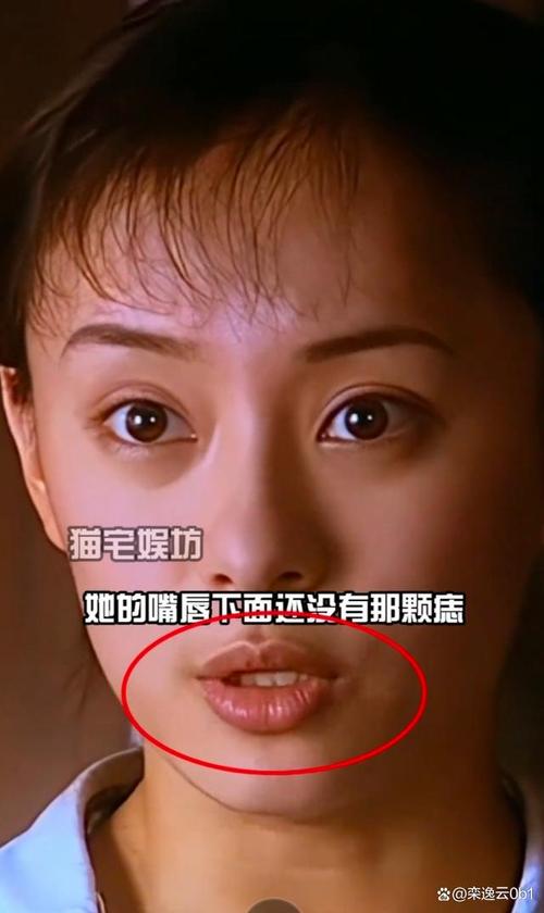 2025澳门全年資料免費大全和孙俪唇下痣没了与孙俪嘴唇的痣