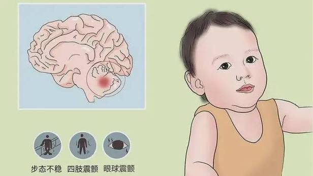 新澳2025今晚开奖结果和送小脑萎缩儿子高考与小脑萎缩能上学吗
